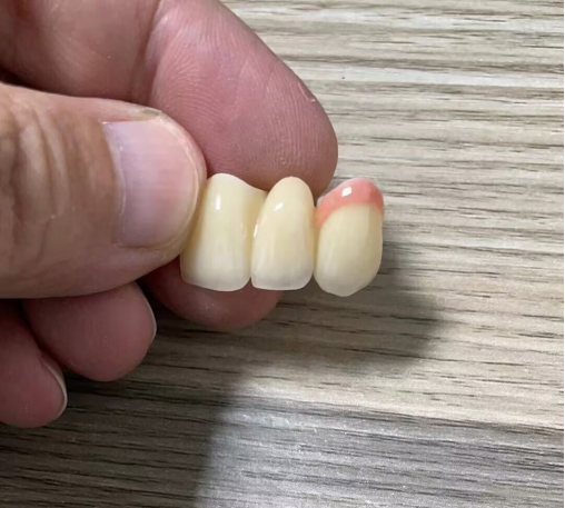 哪家义齿工厂有 CE FDA 认证?选深圳 Myy 义齿加工厂 6